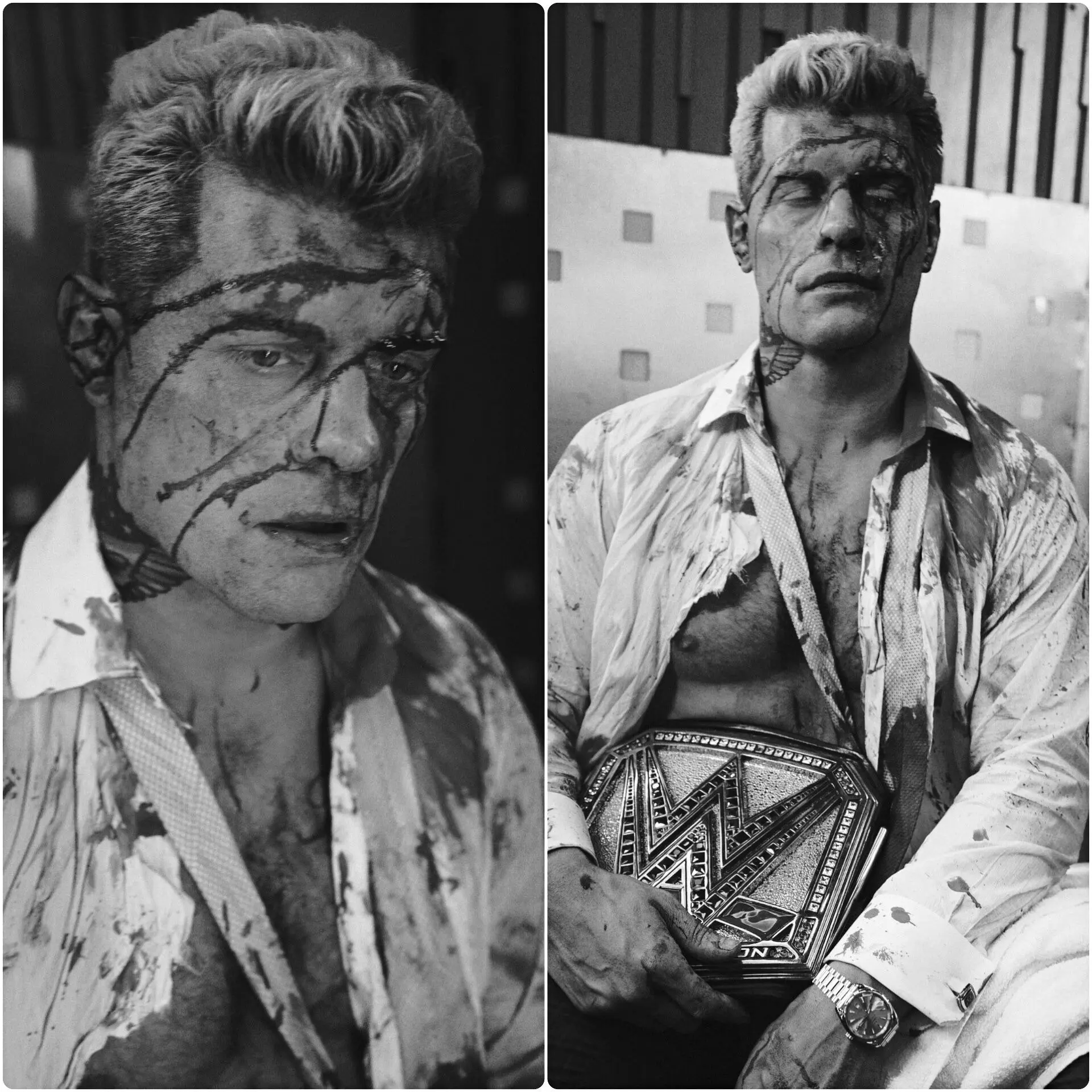 Cover Image for 🥺💔 Cody Rhodes following the brutal attack from Randy Orton… The man who trusted him the most… got betrayed by him. 👇