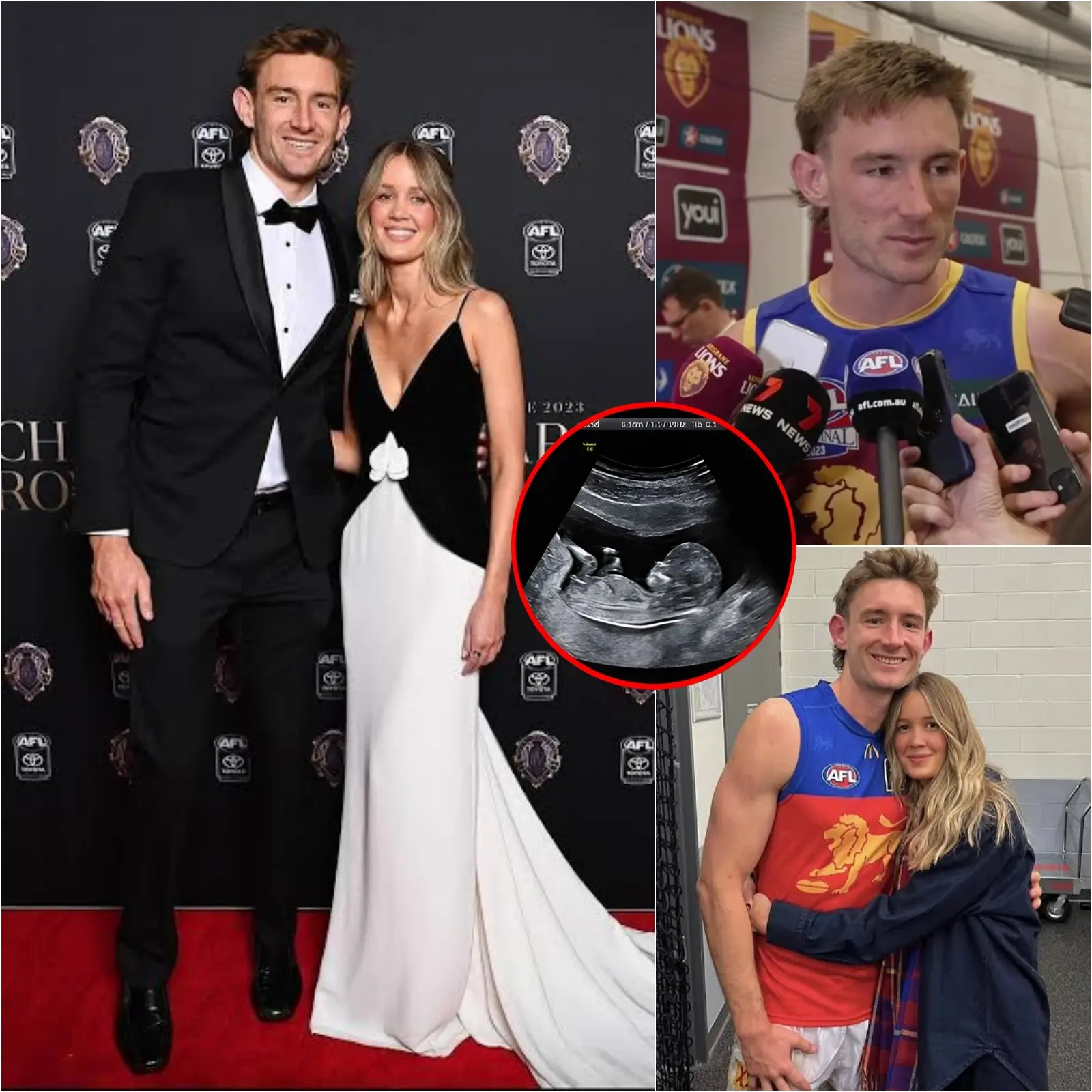 Cover Image for ❤️ GREAT NEWS JUST A FEW MINUTES AGO: Harris Andrews announced that his girlfriend has welcomed their first child. He has revealed the baby’s name and gender, and Brisbane Lions fans and the entire AFL have been quick to send their congratulations!
