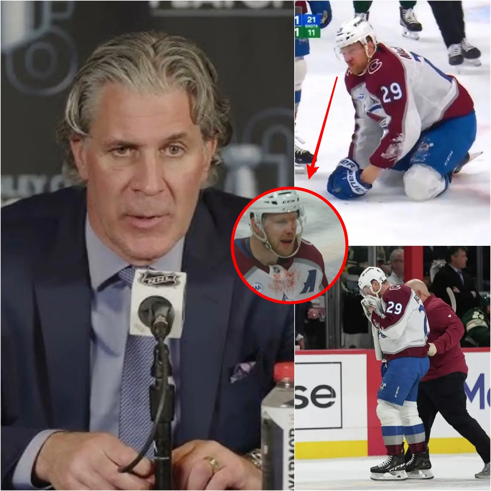 Cover Image for “It’s terrible, I feel sorry for him in the upcoming games” – Coach Jared Bednar recently announced the current situation of star Nathan MacKinnon after being hit by a puck from teammate Devon Toews in the second quarter of Game 4 of the NHL playoffs.