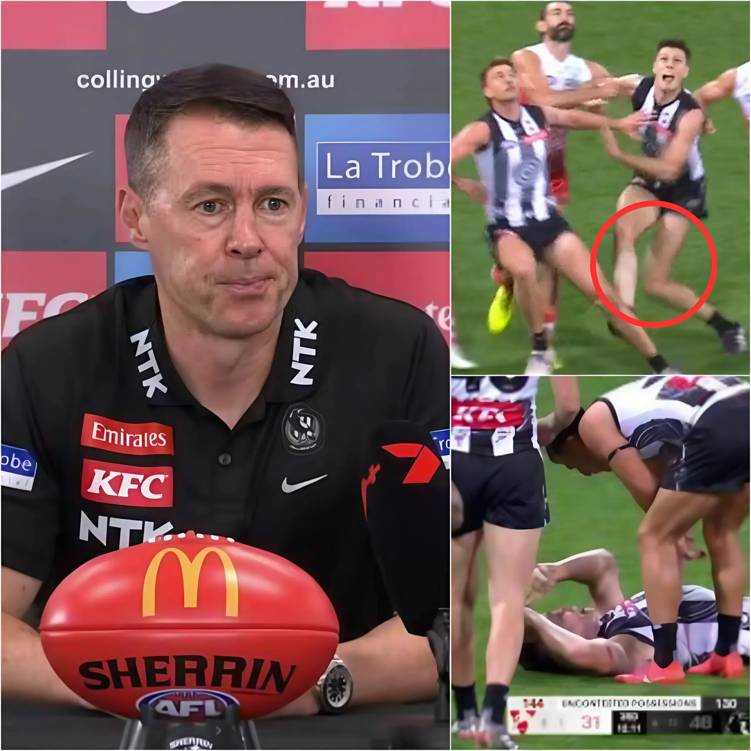 Cover Image for BREAKING NEWS: Collingwood Football Club has confirmed the worst possible news regarding the injury of a promising young striker 💔👇👇👇