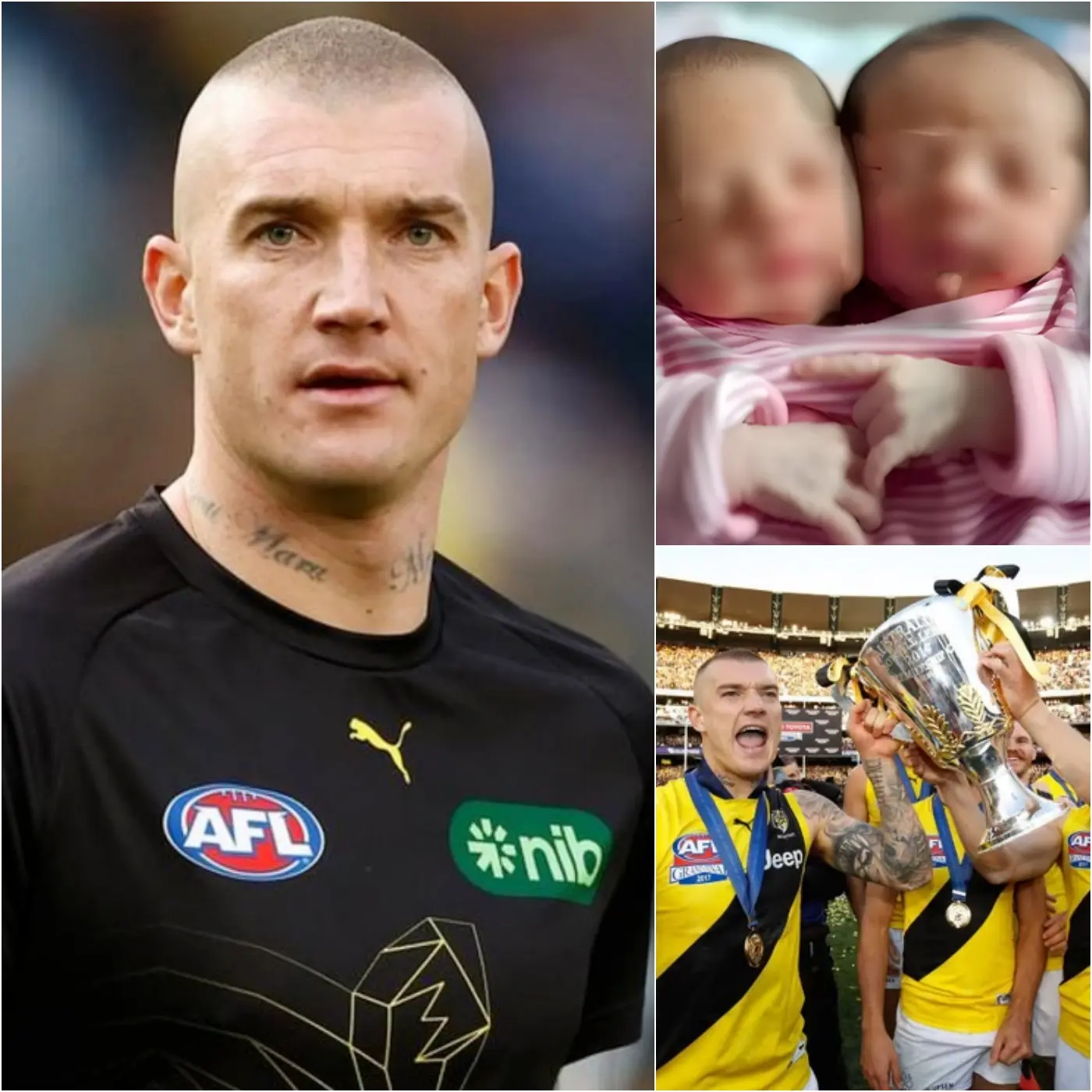Cover Image for đŻA NOBLE ACT: Former Richmond player Dustin Martin touched the hearts of the entire AFL by quietly sponsoring a life-saving surgery to separate conjoined twins and give them a second chance