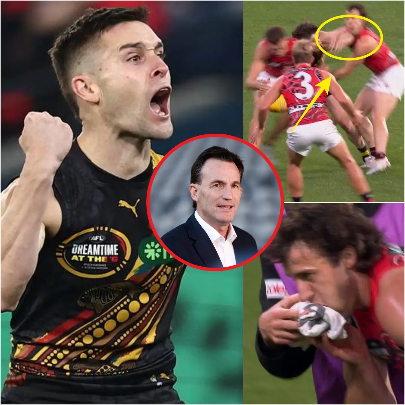 Cover Image for 🚨ONE OF THE SEVEREST PENALTIES IN THE AFL. The Australian Football League’s CEO has confirmed that the Richmond Tigers’ young forward has been officially suspended for one match by the Match Review Board (MRO) for a brutal elbow foul that resulted in Andy McGrath suffering a fractured jaw.