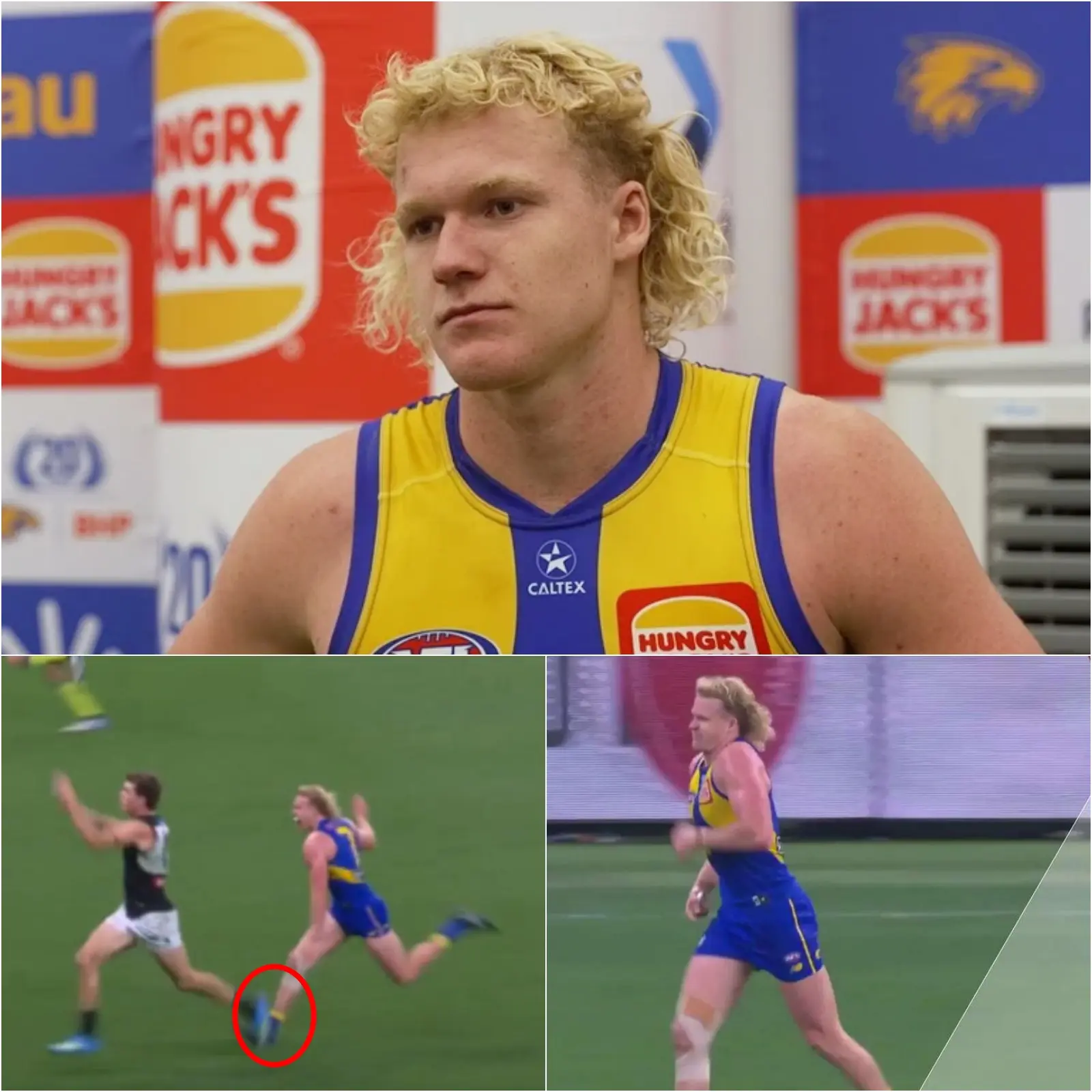 Cover Image for 💔 “A SINGLE MOMENT CHANGED EVERYTHING…” AFL star Reuben Ginbey suffered a mental breakdown after a reckless act that resulted in a serious injury — but a little-noticed detail from the incident is now raising serious questions…😰👇