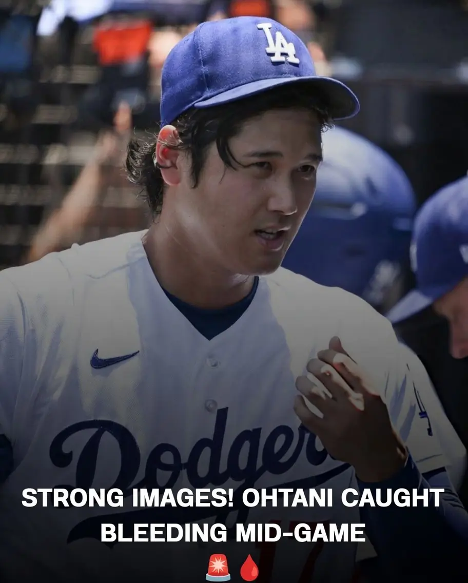 Cover Image for 💣 PANIC IN THE DODGERS! Shohei Ohtani Caught BLEEDING During Game, Setting Off Alarms in MLB. 🤯🇯🇵💔